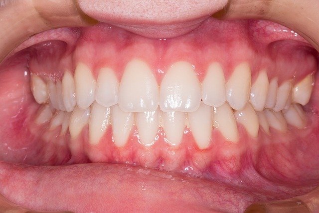 Choosing the best cosmetic dentist at a dental clinic in North York